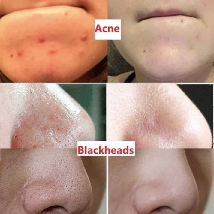 Alvera Green Tea Mask