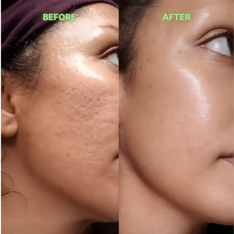 Before and after comparison of a woman's face after using green tea stick mask.