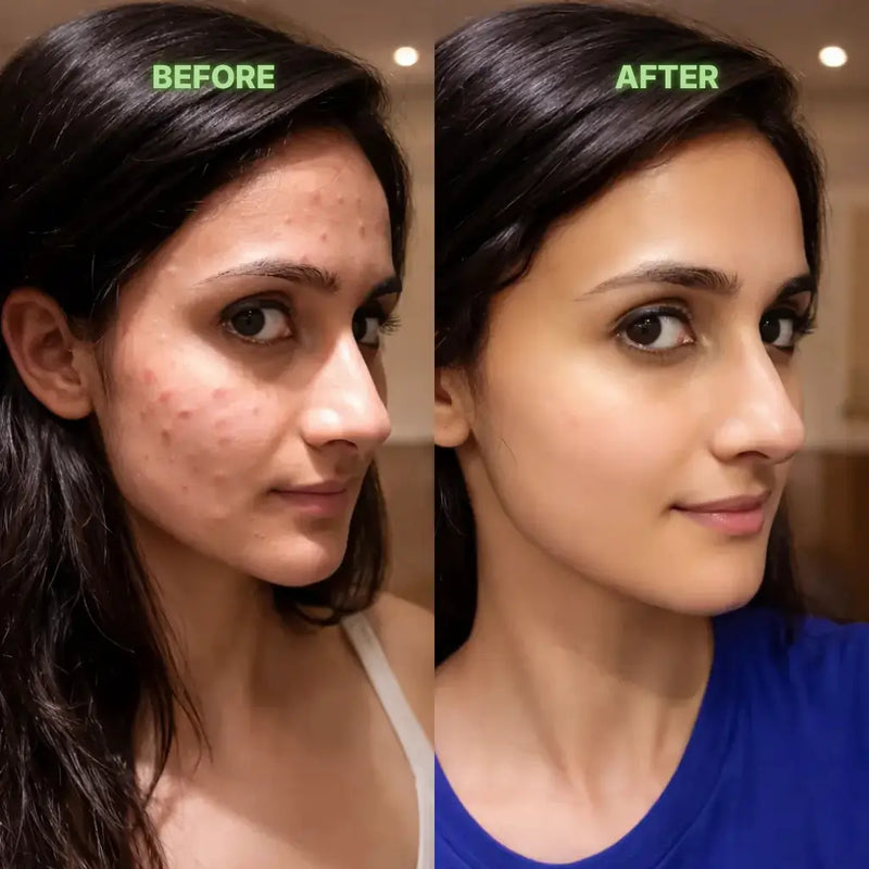 Before and after comparison of a woman's face with visible skin improvement.