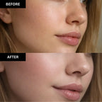 Before and after comparison of a woman's face with visible skin improvement.
