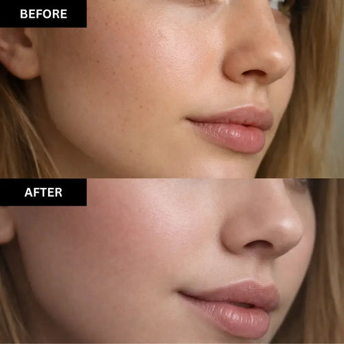 Before and after comparison of a woman's face with visible skin improvement.